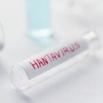 Andes Virus Shifts Hantavirus Conversation for US Labs