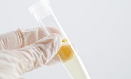 FDA Grants Breakthrough Designation to Urine-Based Alzheimer’s Test