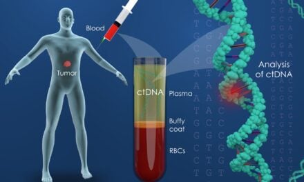 ctDNA Blood Test May Help Guide Treatment Selection for Spreading Cancer