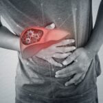 Roche Launches Algorithm Suite for Chronic Liver Disease Management