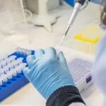 FDA Clears Revvity Total Testosterone Assay for Automated Testing