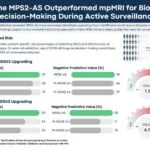 Urine Test Reduced Unnecessary Prostate Biopsies by 64%, Study Finds