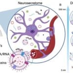 Mount Sinai Researchers Identify Blood RNA Biomarkers for Alzheimer’s Detection