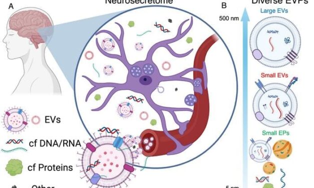 Mount Sinai Researchers Identify Blood RNA Biomarkers for Alzheimer’s Detection