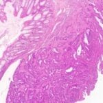New Imaging Technology Could Speed Up Cancer Diagnosis