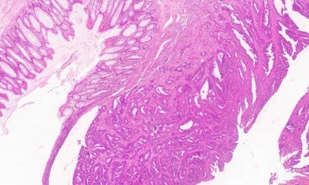 New Imaging Technology Could Speed Up Cancer Diagnosis