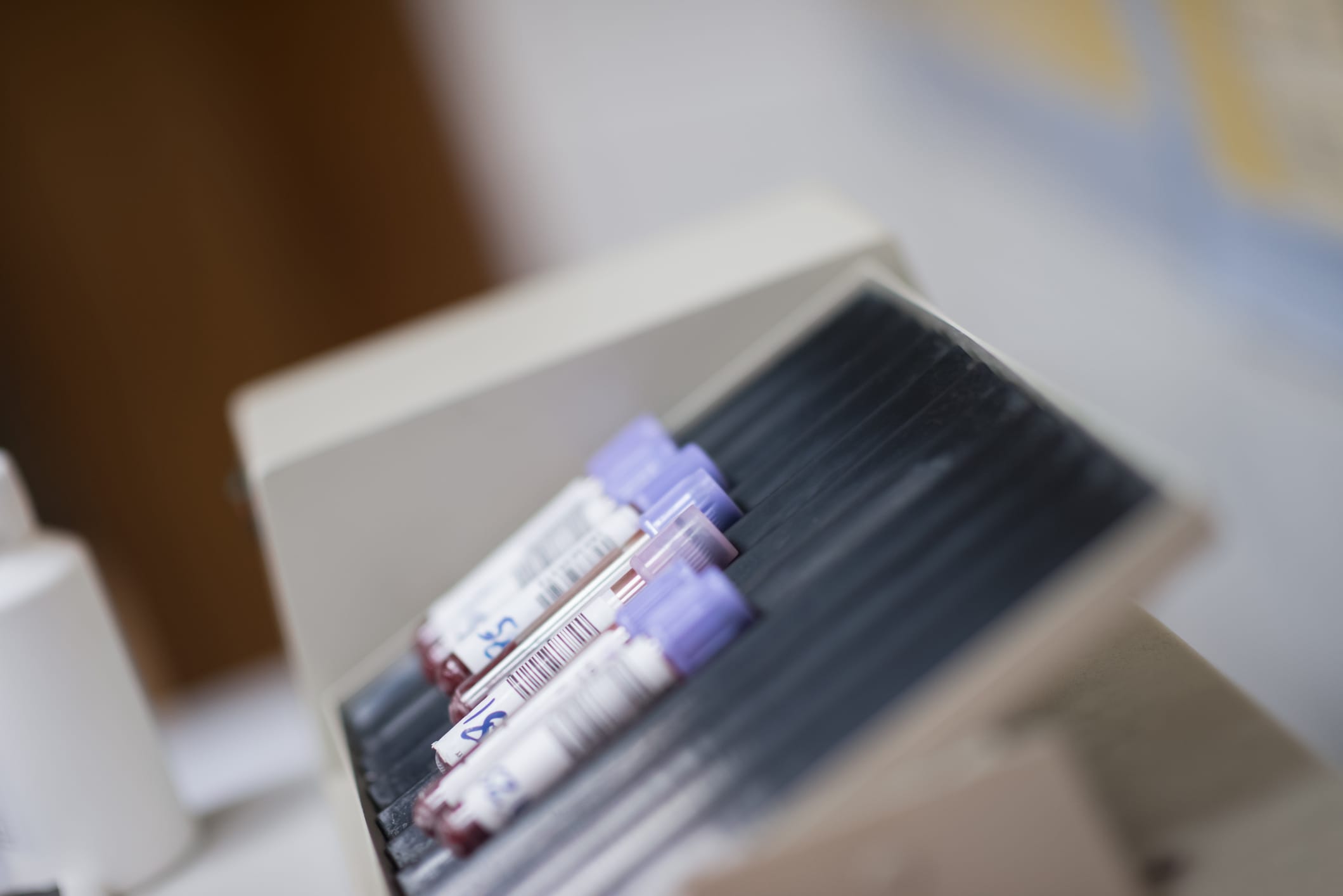 Alzheimer’s Blood Testing: FDA Clearance and Clinical Guidelines in 2025
