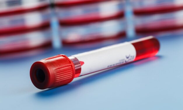 Blood Test for Colon Cancer Improves Chemotherapy Decisions, Study Finds