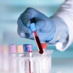 New Clinical Guidelines Recommend Molecular Testing for Bladder Cancer