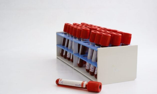 Can a Blood Test Identify Head and Neck Cancer Patients at Risk of Recurrence?
