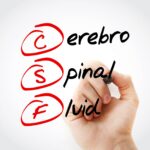 New Guidelines Support CSF Testing for Central Nervous System Cancers