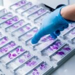 AI Pathology Startup Expands Deployment of Cancer Diagnostic Platform