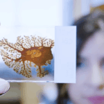 Could a Blood Test  Predict Risk of Brain Swelling During Alzheimer’s Treatment?