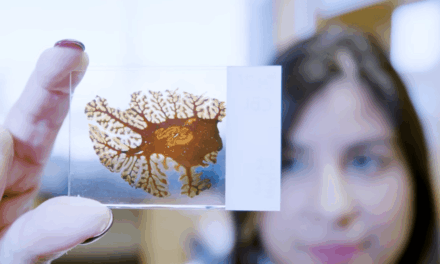 Could a Blood Test  Predict Risk of Brain Swelling During Alzheimer’s Treatment?