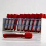 Large Study Shows Multi-Cancer Early Detection Test Increases Cancer Detection
