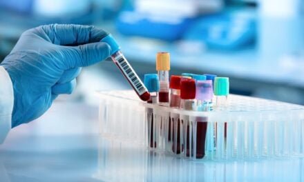 Blood Test Shows High Sensitivity for Early-Stage Lung Cancer Detection