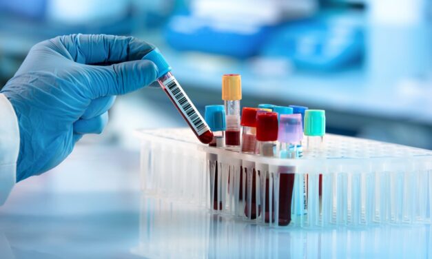 Blood Test Shows High Sensitivity for Early-Stage Lung Cancer Detection