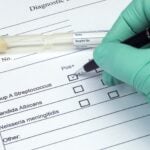 FDA Clears Rapid Molecular Test for Group A Strep