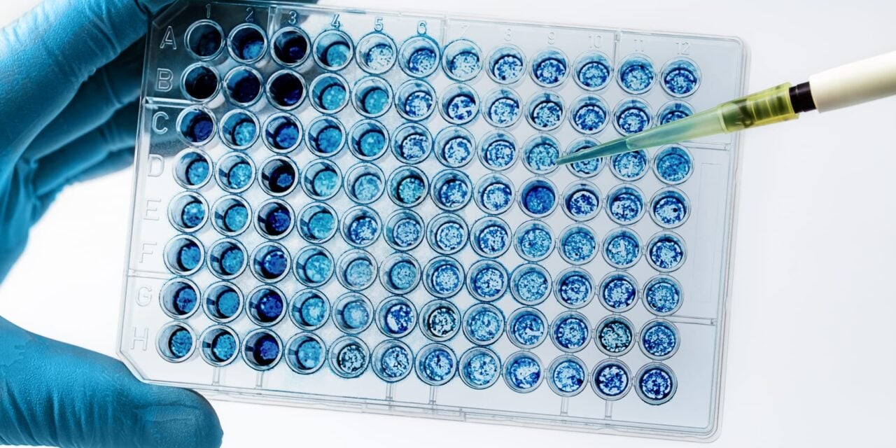 Pictor Unveils High-Resolution Protein Analysis Platform at ADLM 2026