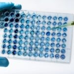 Pictor Unveils High-Resolution Protein Analysis Platform at ADLM 2026