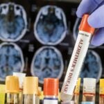 First Commercial Alzheimer’s Tau Tangle Blood Test Launches