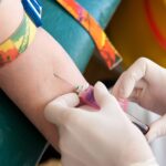 Alzheimer’s Blood Tests Found Effective for Patients with Down Syndrome