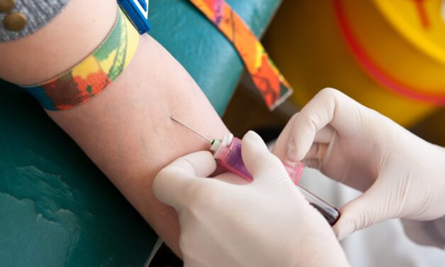Alzheimer’s Blood Tests Found Effective for Patients with Down Syndrome