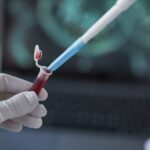 High-Sensitivity Biosensor Identifies Tuberculosis via Blood-Based Bacterial Marker
