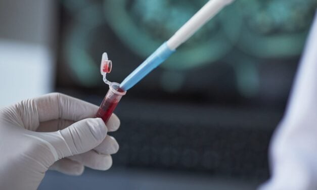 High-Sensitivity Biosensor Identifies Tuberculosis via Blood-Based Bacterial Marker