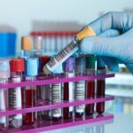FDA Clears New Heart Disease Risk Test for Clinical Labs
