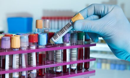 FDA Clears New Heart Disease Risk Test for Clinical Labs
