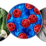 The Cyclospora Outbreak Is Putting Laboratory Testing to the Test