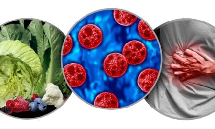The Cyclospora Outbreak Is Putting Laboratory Testing to the Test