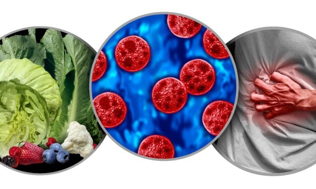 The Cyclospora Outbreak Is Putting Laboratory Testing to the Test