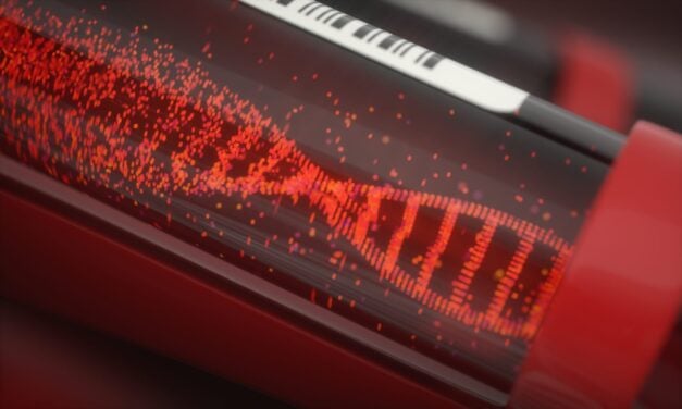 Blood Test May Identify Colorectal Cancer Patients Who Benefit from Chemotherapy