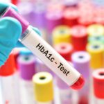 Immunoassays May Underestimate HbA1c in Patients with Sickle Cell Trait