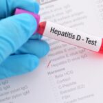 Roche Introduces Automated Test for Hepatitis D Virus