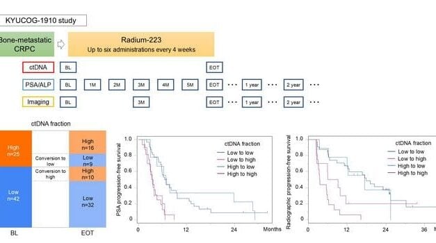 DNA Blood Test Helps Select Prostate Cancer Patients for Radiation Therapy