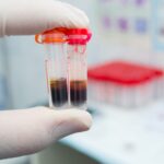 Caresfield Launches Initiative to Address Hemolysis and Supply Chain Risks