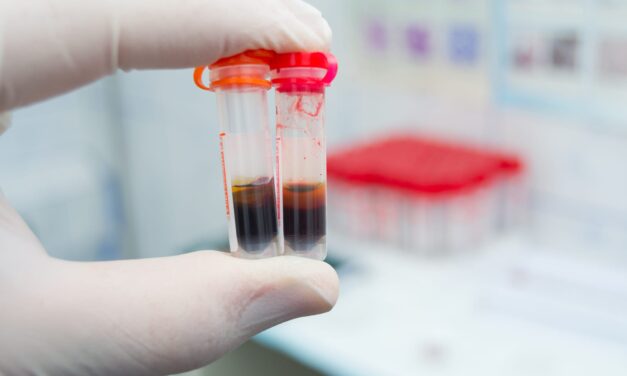 Caresfield Launches Initiative to Address Hemolysis and Supply Chain Risks
