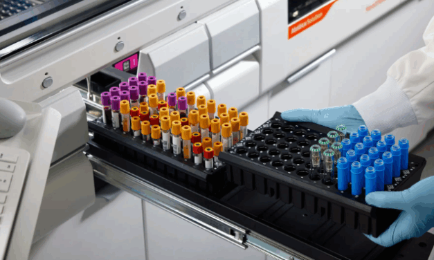 Siemens Healthineers Adds Capillary Blood Testing to Core Lab Analyzers