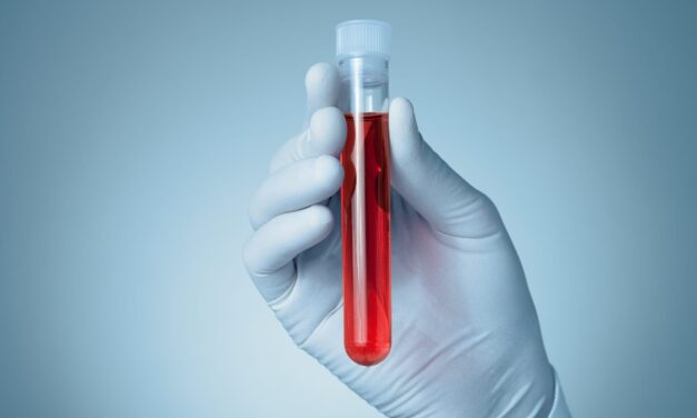 Lilly to Present Data Comparing P-Tau217 Blood Tests With Amyloid PET at AAIC