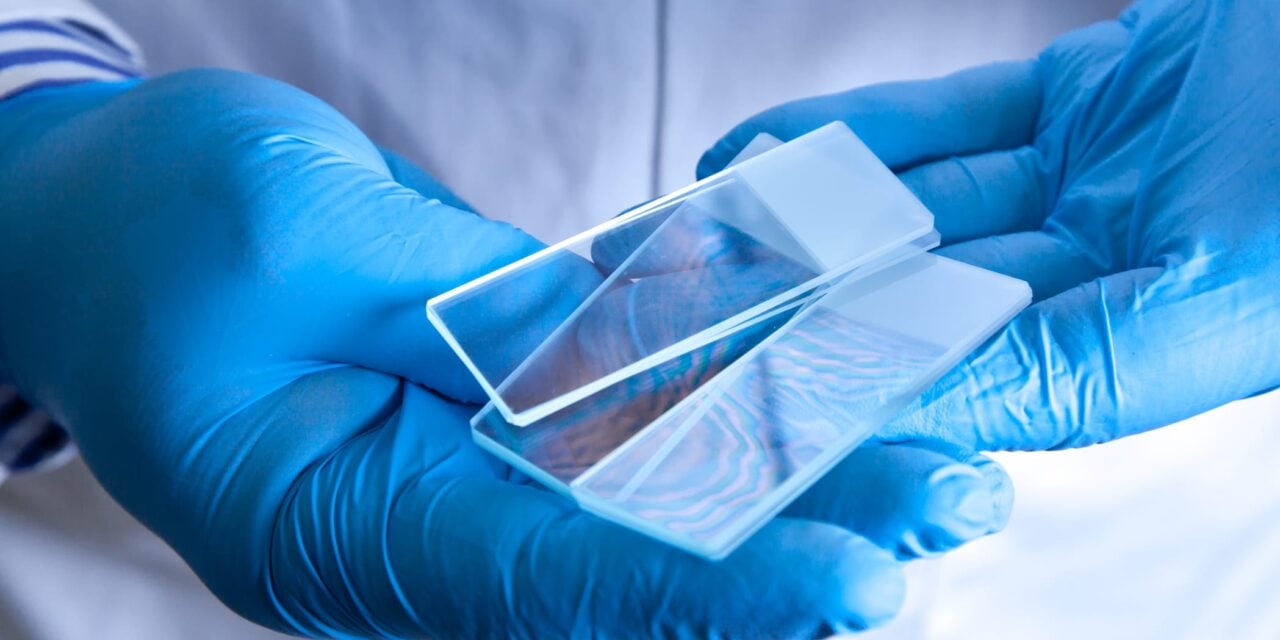 Spotlight Medical Receives European Approval for AI Breast Cancer Test