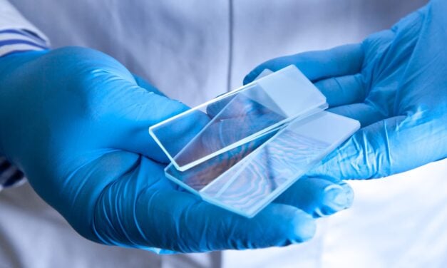 Spotlight Medical Receives European Approval for AI Breast Cancer Test