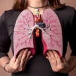 RNA-Based Testing Improves Detection of MET Exon 14 Skipping in Lung Cancer