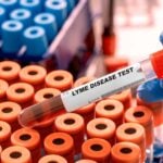 Improved Lyme Disease Tests Could Reduce US Healthcare Costs by 41%