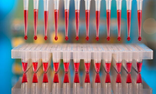Cancer Cell Diagnostics Launches New Blood Test for Cancer Profiling