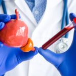 Blood Test Detects Aggressive Prostate Cancer More Accurately Than PSA in Large Study