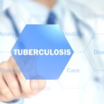 Roche Receives CE Mark for Tuberculosis Blood Test