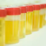 Labcorp to Pay $14.5 Million to Settle Allegations of Unnecessary Urine Drug Testing
